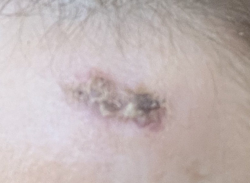 Health professionals…is this infected?