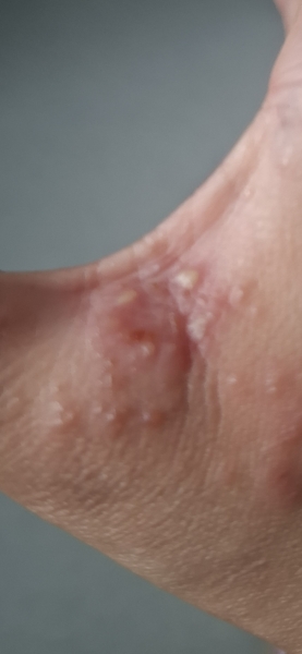 How long till antibiotics kick in?