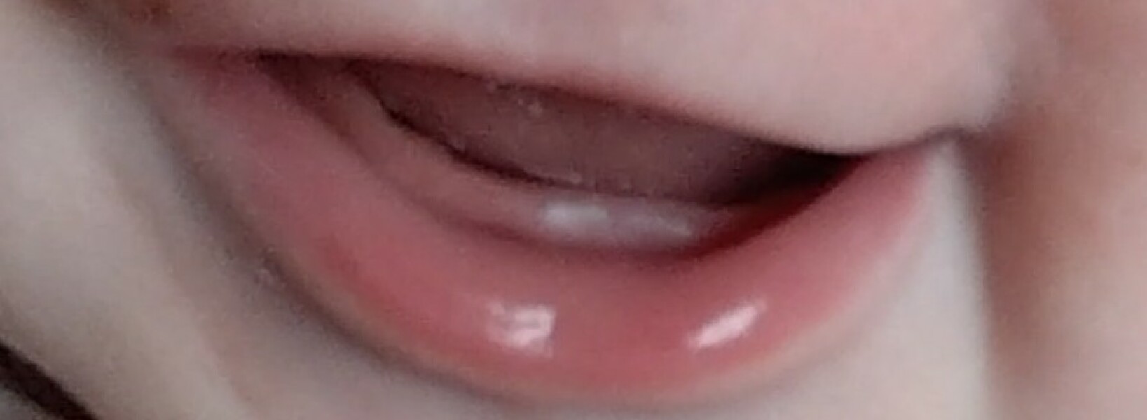 Teeth finally through but baby still off bottles