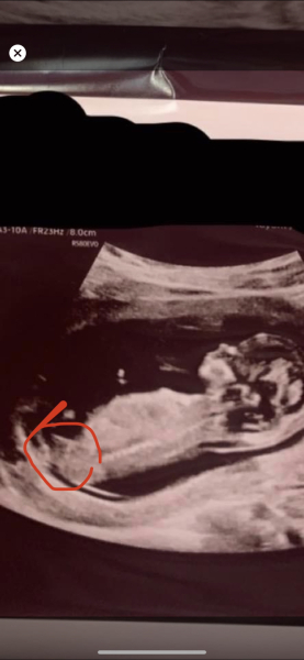 Due February 2025 - Thread 3