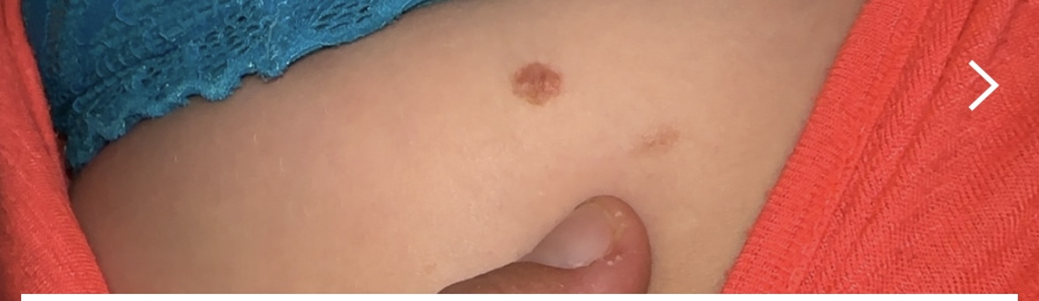 Mole