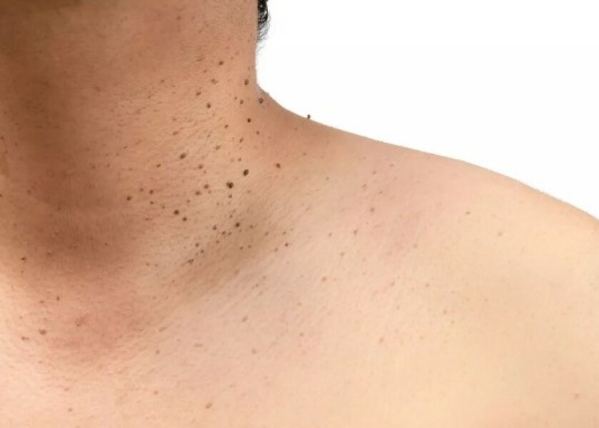 Mounjaro / Wegovy with > 5st / 30kg to lose: Thread 2