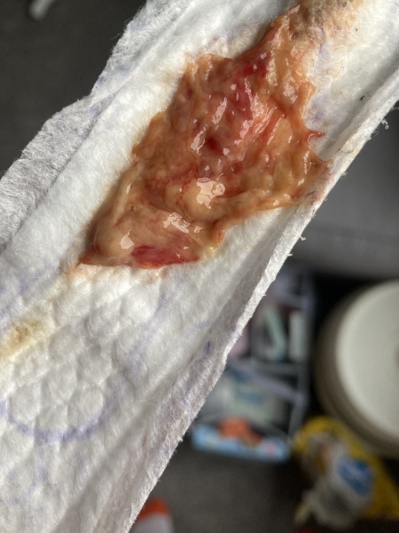 Bloody discharge 4.5 weeks postpartum