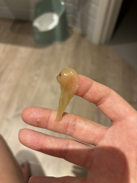Mucus plug?