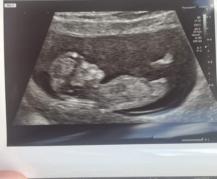 Due February 2025 - Thread 3