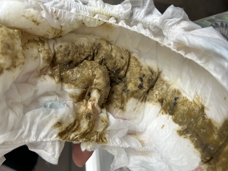 Blood in baby stool??