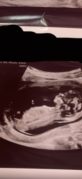 Due February 2025 - Thread 3