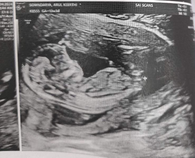 Gender guess - 12 weeks