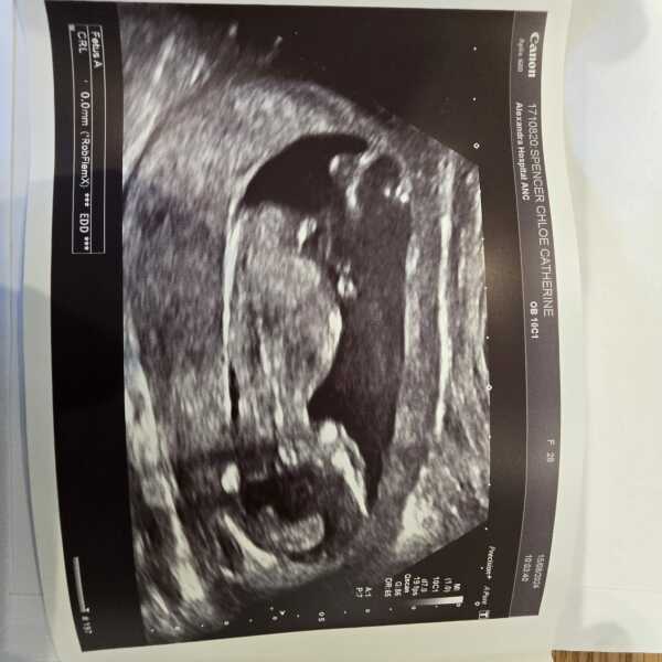 Scan photo / nub theory