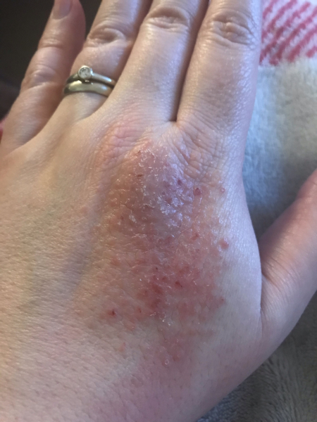 Any idea what this is on my hand? (Photo)