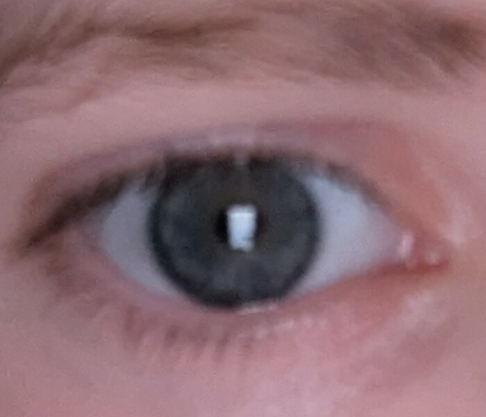 What colour are these eyes?
