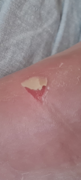 Minor injuries or treat at home?