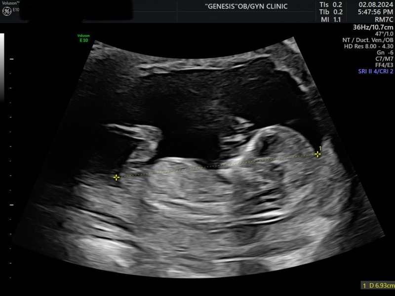 Nub theory prediction wrong?