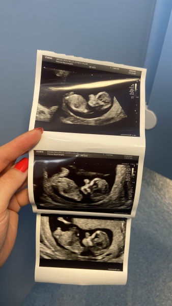 Due February 2025 - Thread 2