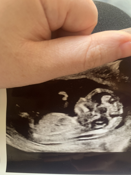 Due February 2025 - Thread 3