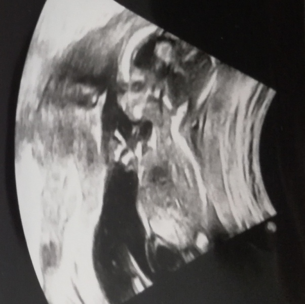 Due Jan 2025