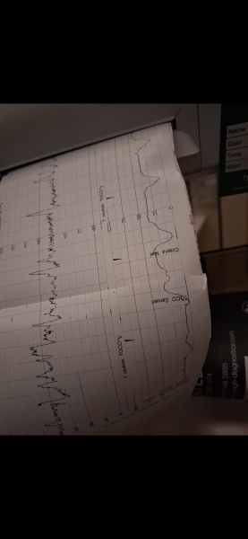 Toco graph