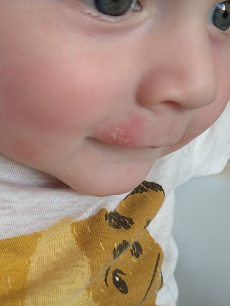 What to use on this?