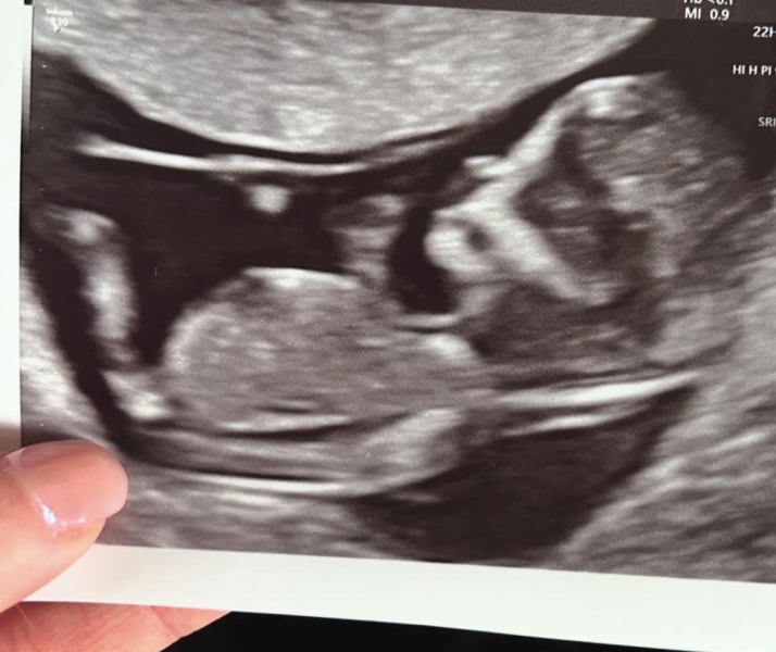 Gender scan - is it correct?