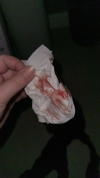 Bloody show or bleeding from membrane sweep?