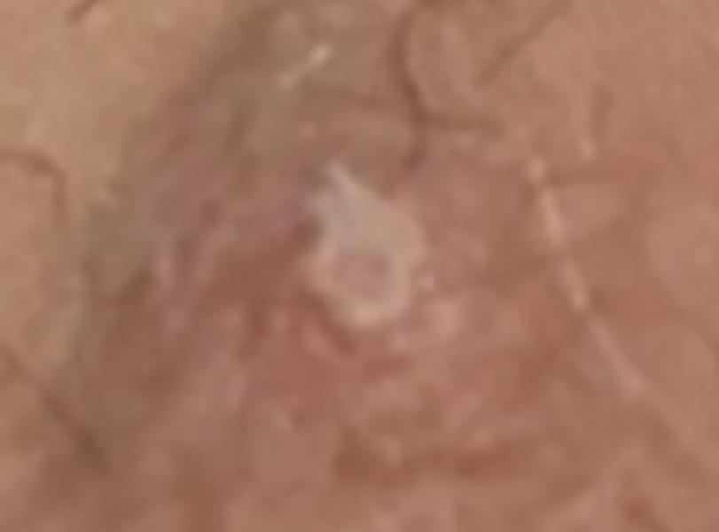 TMI PIC- what is this spot?
