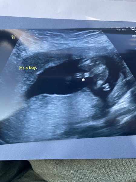 16 week gender scan