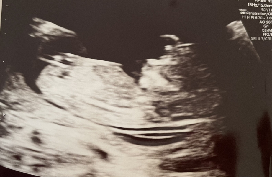 Anyone TTC Dec 2023…continued