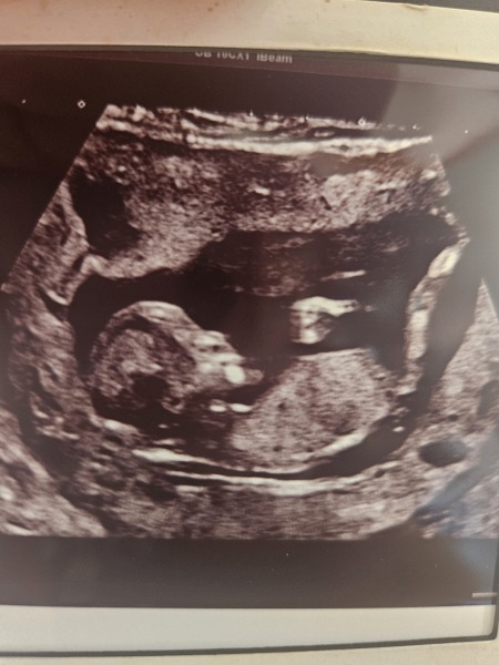 Due February 2025 - Thread 3