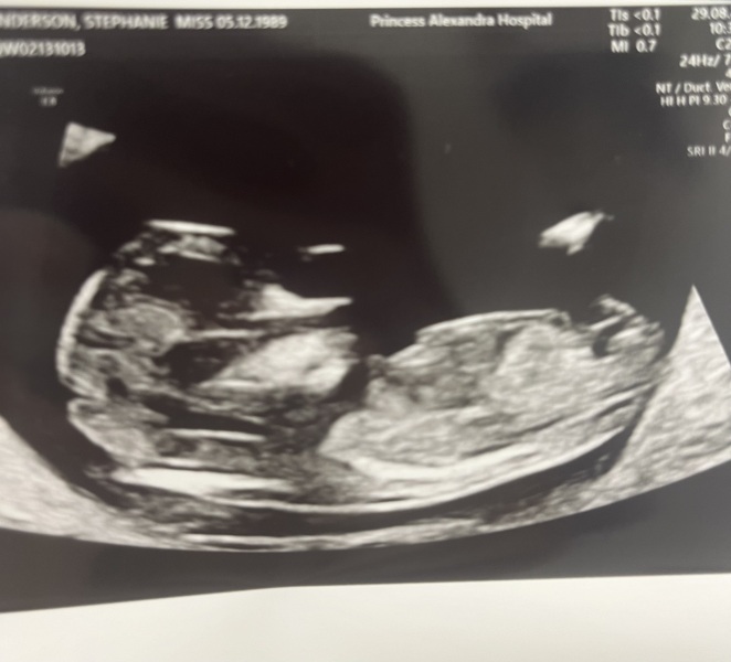 Due March 2025 thread 2