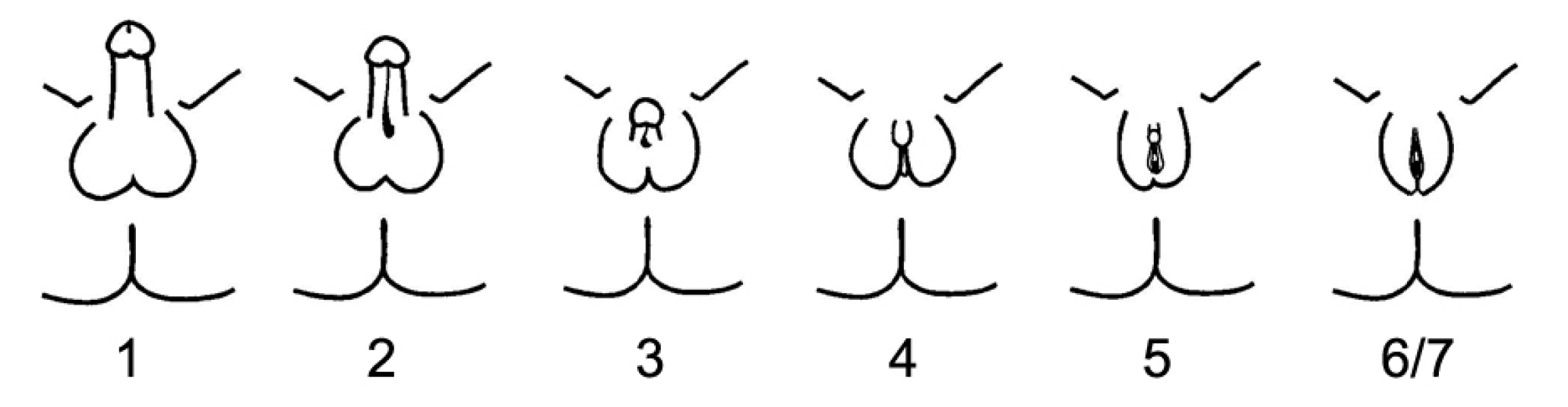 to say women don't have XY chromosomes?