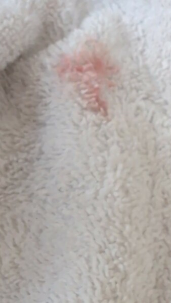 Help is this implantation bleeding