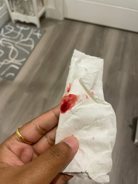 11 weeks 5 days pregnant having bleeding
