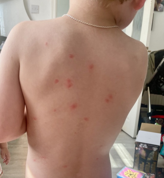 Spots that have come up