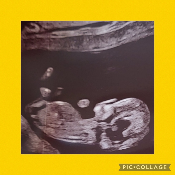 Due February 2025 - Thread 3