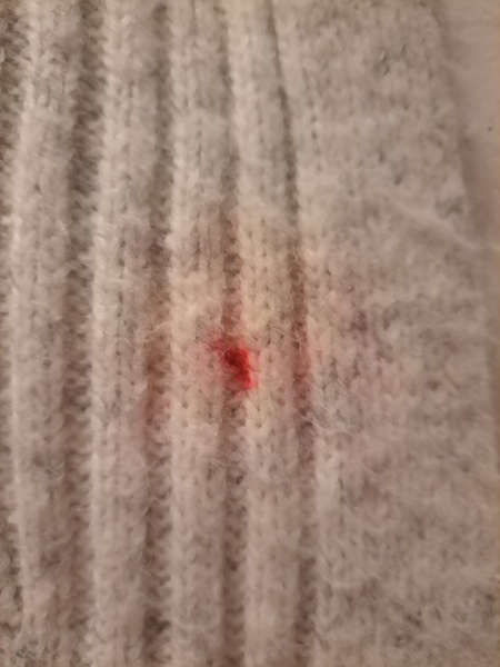 How to get lipstick off a cardigan