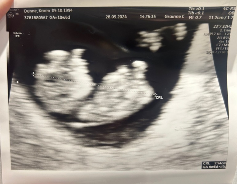 Gender Guesses - distraction needed!