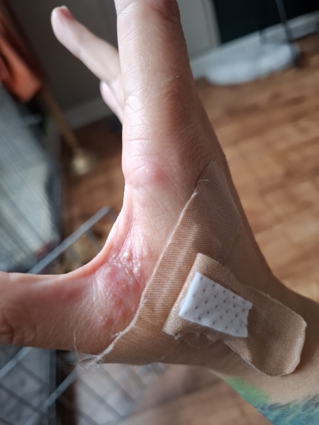 Any idea what this is on my hand? (Photo)