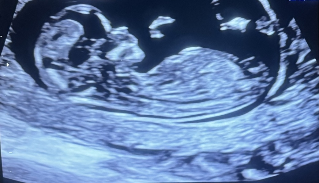 Is it a girl or boy?