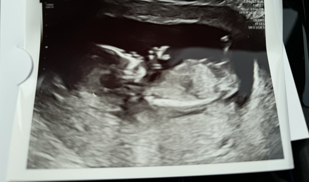 Boy or girl? 🩵🩷