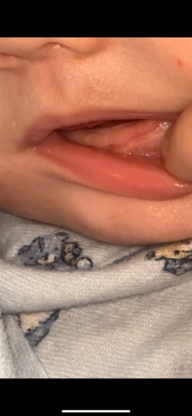 Teething baby