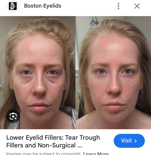 Please fix my eyebags