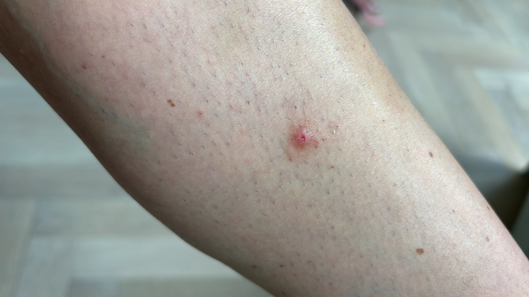Weird spot on leg