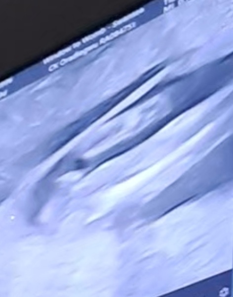Potty shot clarity?
