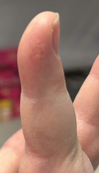 What is this on my finger