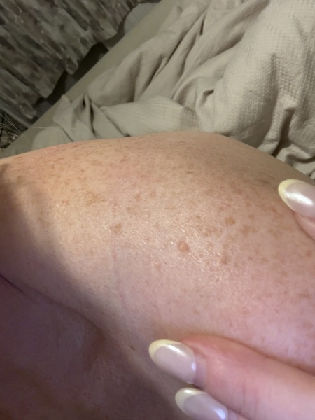 Advice please