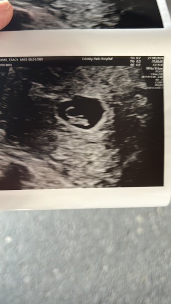 Pregnant over 40