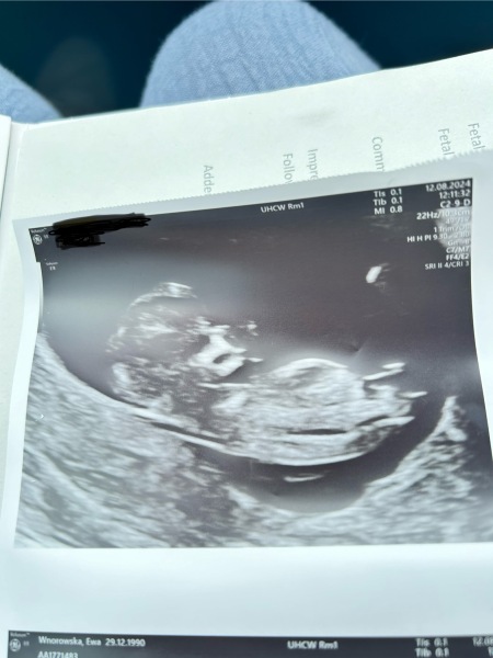 Due February 2025 - Thread 3