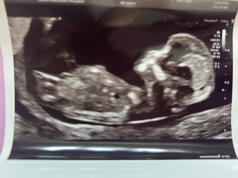 Due March 2025 thread 2