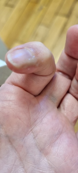 TTC after loss part 5