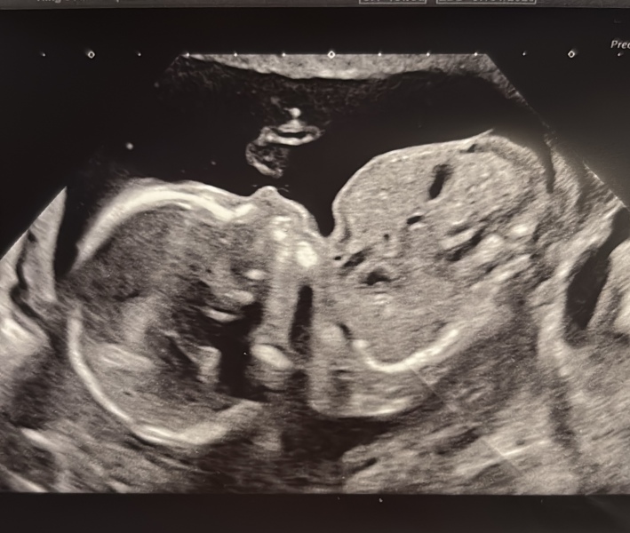 Gender guesses?
